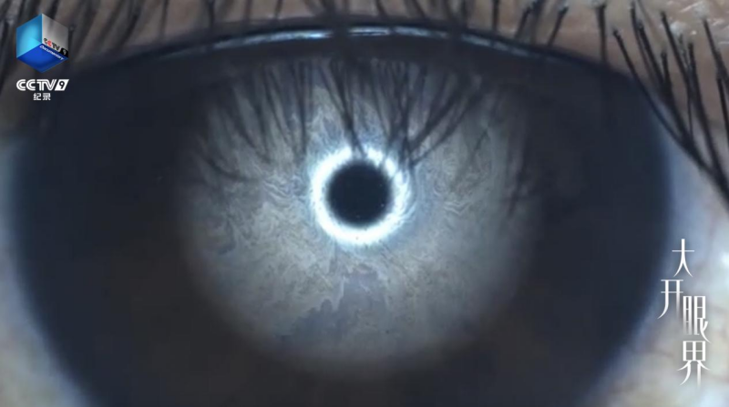 CCTV-9纪录片《大开眼界》：让眼睛真正被“看见”(图6)